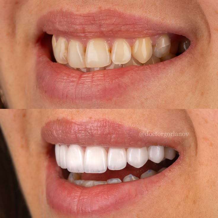 Dentifrice Miswak Charbon XXL 170g - Luvéa